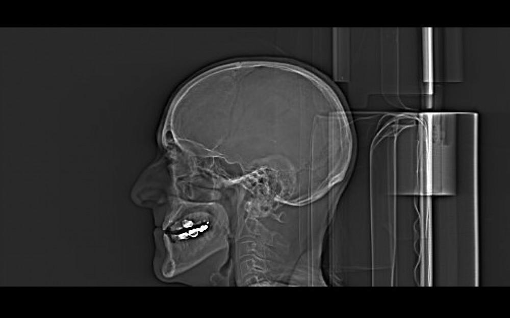 Unbelievable Clutch Play: How a Pro Secured a Major Spot with an Epic Bump-and-Run! Here’s a comma-separated list of highly relevant keywords prioritized from the article heading:
1. Clutch Play
2. Pro
3. Major Spot
4. Epic Bump-and-run
5. Golf Mastery
6.Swing Refinement
7. Strategic Approach
8. Technical Prowess
9. tactical Acumen
These keywords can assist you in finding appropriate and targeted images for the article