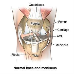 Torn Meniscus